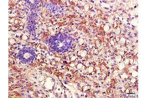 Immunohistochemistry (IHC) image for anti-AKT 1/2/3 (AA 401-479) antibody (ABIN725195)