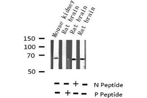 Western blot analysis of Phospho-NF kappaB p65 (Thr435) expression in various lysates (NF-kB p65 antibody  (pThr435))