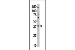 The anti-GEA10 C-term Antibody (ABIN390102 and ABIN2840614) is used in Western blot to detect GEA10 in HL60 lysate. (MAGEA10 antibody  (C-Term))