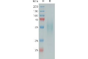 Human DR6 Protein, His Tag on SDS-PAGE under reducing condition.