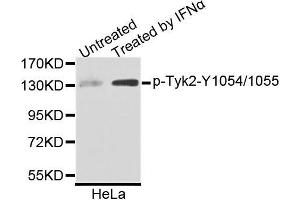 Western blot analysis of extracts of HeLa cells, using Phospho-Tyk2-Y1054/1055 antibody (ABIN5996365). (TYK2 antibody  (pTyr1054, pTyr1055))