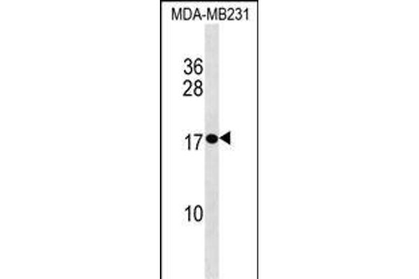 PLAC1 Antikörper  (C-Term)