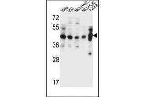 Western blot analysis of GTF2H2C Antibody (C-term) in Hela, 293, NCI-H460, NCI-H292, A2058 cell line lysates (35ug/lane). (GTF2H2C antibody  (C-Term))