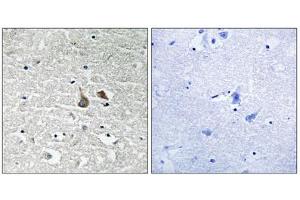 Immunohistochemistry analysis of paraffin-embedded human brain tissue using IRAK1 (Phospho-Ser376) antibody. (IRAK1 antibody  (pSer376))