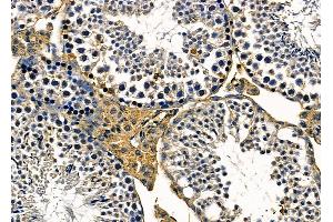 ABIN6263526 and ABIN6279596 at 1/100 staining mouse testis tissue by IHC-P. (NBPF3 antibody  (Internal Region))