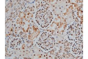 ABIN6255746 and ABIN6268991 at 1/200 staining human kidney tissue sections by IHC-P. (PPP1R12A antibody  (pThr853))