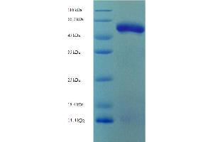 SDS-PAGE (SDS) image for Fibrinogen-Like 2 (FGL2) (AA 24-439) protein (His tag) (ABIN5711287) (FGL2 Protein (AA 24-439) (His tag))