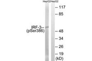 Western Blotting (WB) image for anti-Interferon Regulatory Factor 3 (IRF3) (AA 352-401), (pSer386) antibody (ABIN1532087)