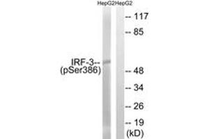 Western blot analysis of extracts from HepG2 cells treated with EGF 200ng/ml 30', using IRF-3 (Phospho-Ser386) Antibody. (IRF3 antibody  (pSer386))