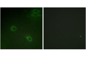 Immunofluorescence analysis of HeLa cells, using CXCR4 (Phospho-Ser339) Antibody. (CXCR4 antibody  (pSer339))