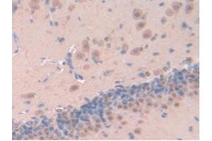 IHC-P analysis of Rat Brain Tissue, with DAB staining. (Leptin antibody  (AA 22-167))