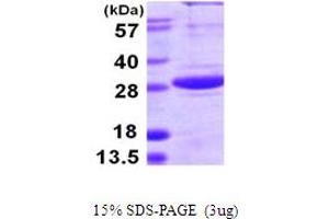 SPSB1 Protein (AA 24-233) (His tag)