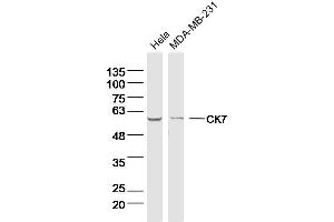Lane 1: Hela lysates Lane 2: MDA-MB-231 lysates probed with CK7 Polyclonal Antibody, Unconjugated  at 1:300 dilution and 4˚C overnight incubation. (Cytokeratin 7 antibody)