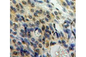 Used in DAB staining on fromalin fixed paraffin-embedded Ovary tissue (HMGN1 antibody  (AA 14-100))
