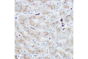 Immunohistochemistry of paraffin-embedded human liver using Heme Oxygenase 1 (HO-1/HMOX1) Rabbit pAb (ABIN3021906, ABIN3021907, ABIN3021908 and ABIN6217466) at dilution of 1:100 (40x lens). (HMOX1 antibody  (AA 1-288))