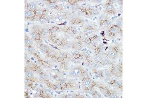 Immunohistochemistry of paraffin-embedded human liver using Heme Oxygenase 1 (HO-1/HMOX1) Rabbit pAb (ABIN3021906, ABIN3021907, ABIN3021908 and ABIN6217466) at dilution of 1:100 (40x lens). (HMOX1 antibody  (AA 1-288))