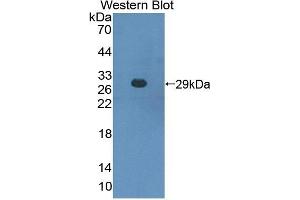 Detection of Recombinant CBFb, Mouse using Polyclonal Antibody to Core Binding Factor Beta Subunit (CBFb) (CBFB antibody  (AA 1-187))