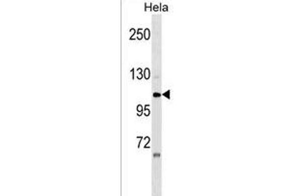 ZNF33A antibody  (N-Term)