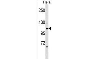 ZNF33A Antibody (N-term) (ABIN1539574 and ABIN2849907) western blot analysis in Hela cell line lysates (35 μg/lane). (ZNF33A antibody  (N-Term))