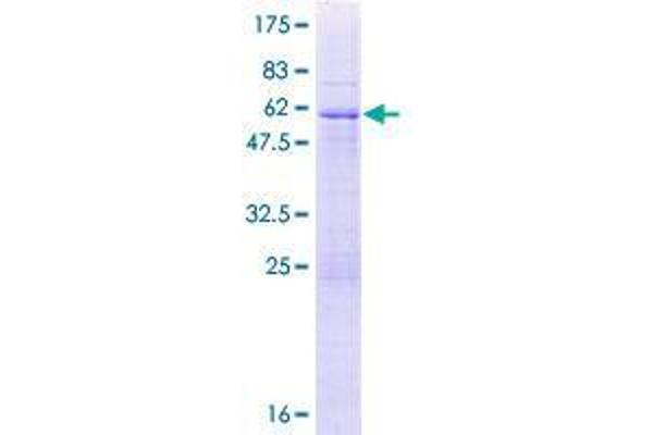 UNKL Protein (AA 1-277) (GST tag)