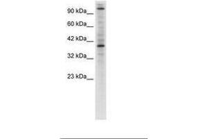 Image no. 1 for anti-Zinc Finger Protein 624 (ZNF624) (AA 499-548) antibody (ABIN6735933) (ZNF624 antibody  (AA 499-548))
