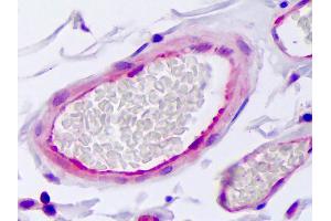 Anti-SERPINE1 / PAI-1 antibody IHC of human vascular endothelium. (PAI1 antibody)