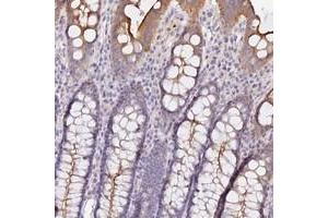 Immunohistochemical staining of human colon with CAMSAP3 polyclonal antibody  shows moderate cytoplasmic positivity in glandular cells at 1:50-1:200 dilution. (CAMSAP3 antibody)