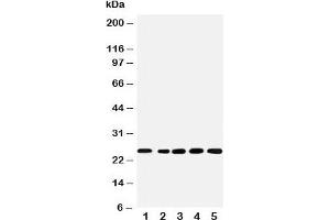 Western blot testing of SNRPN antibody and Lane 1:  rat kidney;  2: human U87;  3: (h) HeLa;  4: (h) HMY;  5: (m) NEUR cell lysate