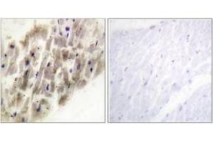 Immunohistochemistry analysis of paraffin-embedded human heart, using MAPKAPK-2 (Phospho-Thr222) Antibody. (MAPKAP Kinase 2 antibody  (pThr222))