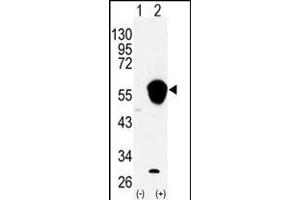 Western blot analysis of ALDH3A1 (arrow) using rabbit polyclonal ALDH3A1 Antibody (N-term) (ABIN392318 and ABIN2841969). (ALDH3A1 antibody  (N-Term))