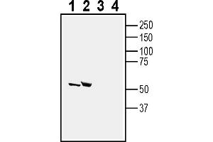 anti-5-Hydroxytryptamine (serotonin) Receptor 2C (HTR2C) (AA 243-256), (Extracellular) antibody