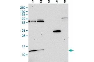 Western blot analysis of Lane 1: RT-4, Lane 2: U-251 MG, Lane 3: Human Plasma, Lane 4: Liver, Lane 5: Tonsil with MRP63 polyclonal antibody .