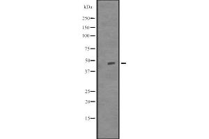 Western blot analysis of TUBD1 expression in Delta 1 Tubulin transfected 293T cell lysate,The lane on the left is treated with the antigen-specific peptide.