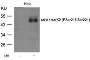 Image no. 1 for anti-Mitogen-Activated Protein Kinase Kinase 1 (MAP2K1) (pSer218), (pSer221) antibody (ABIN196945) (MEK1 antibody  (pSer218, pSer221))