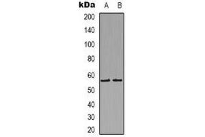 Western blot analysis of Histamine H1 Receptor expression in Hela (A), COLO205 (B) whole cell lysates. (HRH1 antibody)