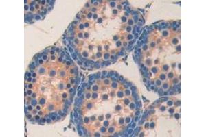 Figure. (Angiotensin I Converting Enzyme 1 antibody  (AA 504-597))