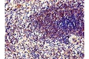 Immunohistochemistry of paraffin-embedded human spleen tissue using ABIN7169292 at dilution of 1:100 (PPP6C antibody  (Catalytic Subunit))
