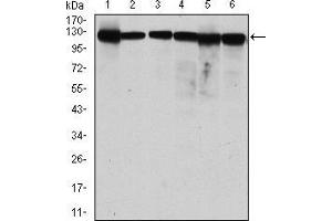 Western blot analysis using MCM2 mouse mAb against MCF-7 (1), Hela (2), Jurkat (3), K562 (4), HEK293 (5) and HEPG2 (6) cell lysate.