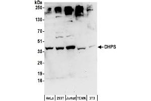 Western Blotting (WB) image for anti-Deoxyhypusine Synthase (DHPS) (AA 319-369) antibody (ABIN7450987)