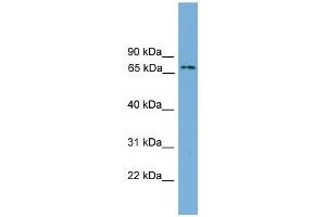 WB Suggested Anti-Ifi204 Antibody Titration:  0. (Ifi204 antibody  (Middle Region))