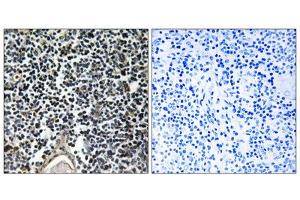 Immunohistochemistry analysis of paraffin-embedded human thymus gland tissue, using ABCB7 antibody. (ABCB7 antibody  (C-Term))