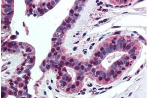 Human Breast (formalin-fixed, paraffin-embedded) stained with Histone H4 antibody ABIN294329 at 5 ug/ml followed by biotinylated goat anti-rabbit IgG secondary antibody ABIN481713, alkaline phosphatase-streptavidin and chromogen. (Histone H4 antibody  (AA 15-30))