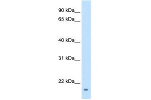 WB Suggested Anti-FAM107A Antibody Titration:  1 ug/ml  Positive Control:  Transfected 293T (FAM107A antibody  (Middle Region))