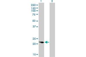 Western Blot analysis of CAPS expression in transfected 293T cell line by CAPS monoclonal antibody (M01), clone 4C6. (Calcyphosine antibody  (AA 1-109))