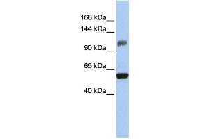 Human HeLa; WB Suggested Anti-ZSCAN20 Antibody Titration: 0. (ZSCAN20 antibody  (Middle Region))