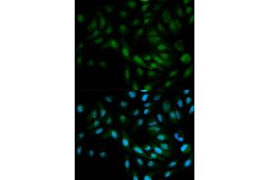 Immunofluorescence analysis of MCF-7 cells using MAPK7 antibody (ABIN5971137). (MAPK7 antibody)