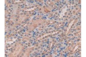 IHC-P analysis of Mouse Kidney Tissue, with DAB staining. (Peroxiredoxin 2 antibody  (AA 6-164))