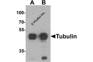 Western Blotting (WB) image for anti-alpha Tubulin (TUBA1) (N-Term) antibody (ABIN1077421) (alpha Tubulin antibody  (N-Term))