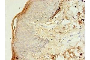 Immunohistochemistry of paraffin-embedded human skin tissue using ABIN7171883 at dilution of 1:100 (Tetraspanin 6 antibody  (AA 115-208))