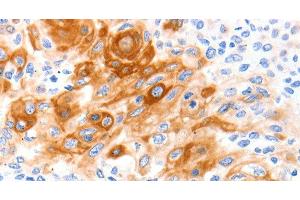 SLC2A11 antibody
